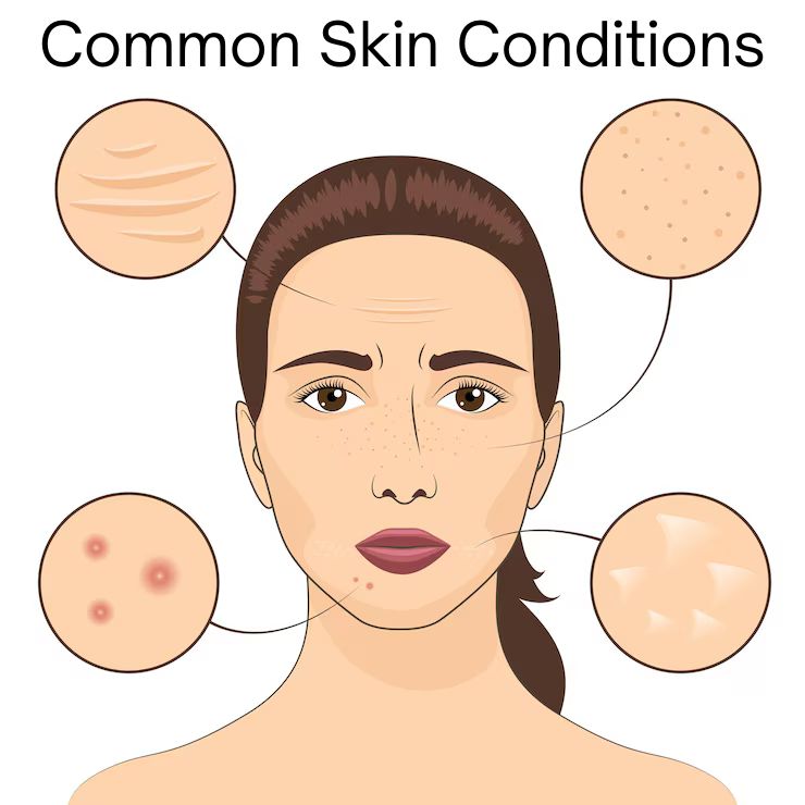 Common Skin Conditions: Causes, Symptoms, and Skincare Tips for Healthy Skin