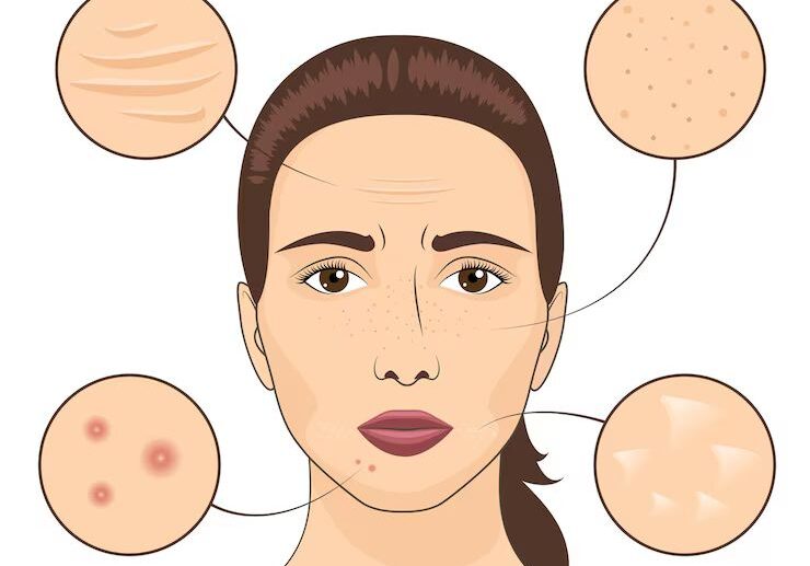 Common Skin Conditions: Causes, Symptoms, and Skincare Tips for Healthy Skin